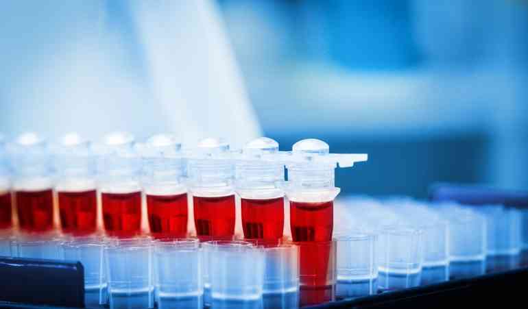 Как сдать анализ крови на рак простаты?