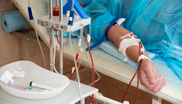 Процедура плазмофереза для очищения крови от алкогольных токсинов