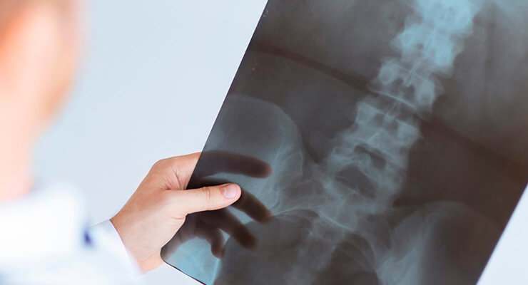 Как проводится рентгенография и что она позволяет выявить?