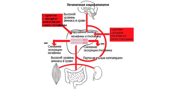 Схема печеночной энцефалопатии