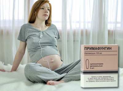 Свечи primafungin для беременной