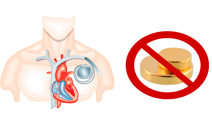 Запрет на использование биомагнита людям с кардиостимулятором