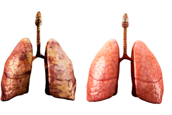 Сравнение легких курильщика и здорового человека