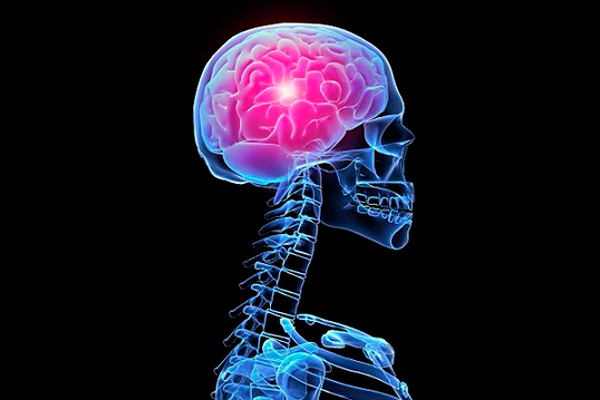 Отек мозга - один из симптомов абстинентного синдрома