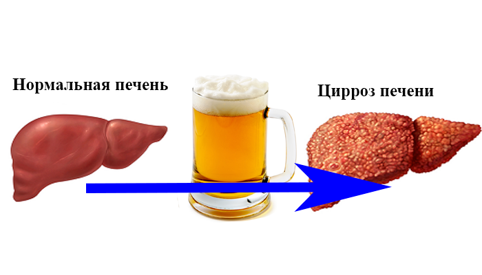 Пиво и холестерин