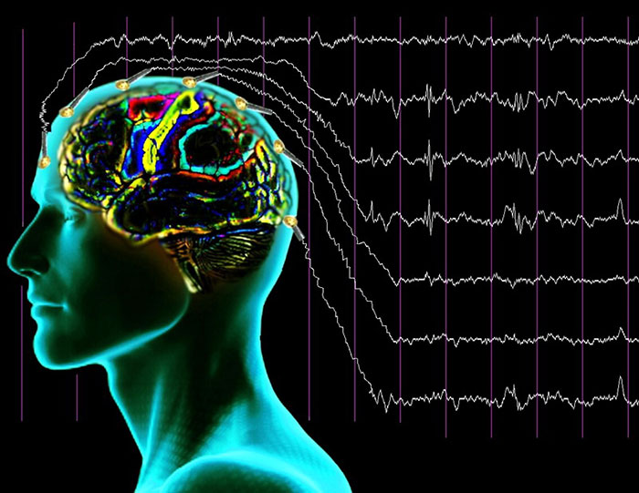 Интракраниальная транслокация подразумевает нейрофизиологическое воздействие на отдельные участки мозга
